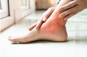 broken ankle